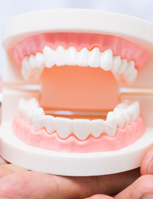 Imagem JPG, Tratamento - Prótese Dentária